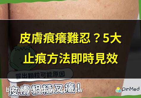 皮膚痕癢難忍？5大止痕方法即時見效 | 全身痕癢點算好？中醫教你急救止痕 | 秋冬皮膚痕癢？10個保濕秘訣大公開 | 皮膚痕癢原因多？專家解析5大常見問題